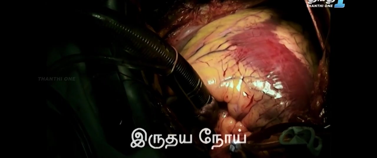 Moviesda.Mobi - Marichi 2024 Original 720p HD.mp4
