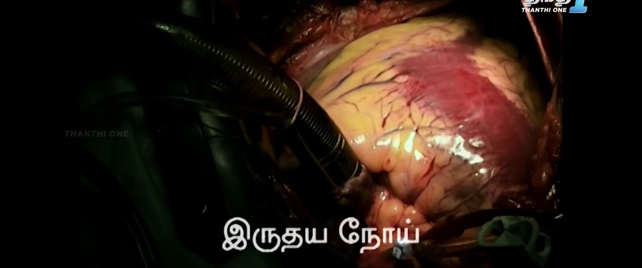 Moviesda.Mobi - Chitra Kadhai 2024 Original 720p HD (550MB).mp4